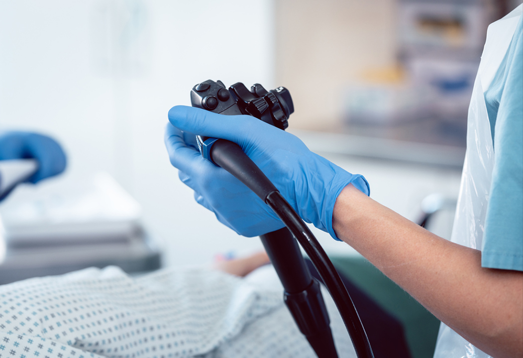 内視鏡検査について