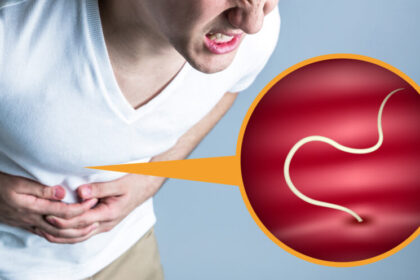 アニサキスは自然治癒に何日かかるか？