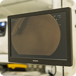 高精細4Kの大型モニターで小さな病変も見逃さない工夫